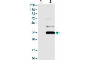 Western blot analysis of Lane 1: Negative control (vector only transfected HEK293T lysate), Lane 2: Over-expression Lysate (Co-expressed with a C-terminal myc-DDK tag (~3. (YAE1D1 Antikörper)