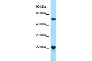 Western Blotting (WB) image for anti-Zinc Finger, DHHC-Type Containing 12 (ZDHHC12) (N-Term) antibody (ABIN2788534) (ZDHHC12 Antikörper  (N-Term))