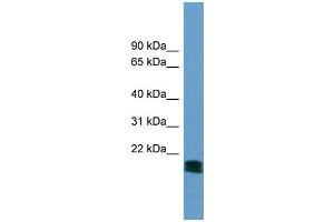 WB Suggested Anti-NT5M  Antibody Titration: 0.