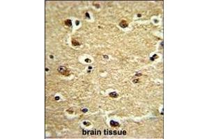 Formalin-fixed and paraffin-embedded human brain tissue reacted with CROT Antibody (N-term), which was peroxidase-conjugated to the secondary antibody, followed by DAB staining. (CROT Antikörper  (N-Term))