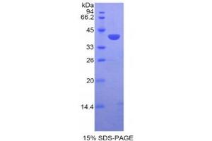 SDS-PAGE (SDS) image for Chemokine (C-C Motif) Ligand 21 (CCL21) (AA 5-130) protein (His tag,GST tag) (ABIN1878122)