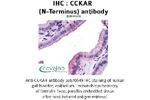 Image no. 1 for anti-Cholecystokinin A Receptor (CCKAR) (Extracellular Domain), (N-Term) antibody (ABIN1732733) (CCKAR Antikörper  (Extracellular Domain, N-Term))