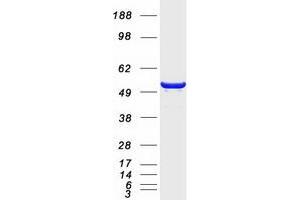 Western Blotting (WB) image for Sorting Nexin 8 (SNX8) protein (Myc-DYKDDDDK Tag) (ABIN2732417)
