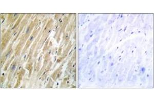 Immunohistochemistry analysis of paraffin-embedded human heart tissue, using CALR Antibody.
