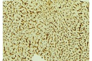 ABIN6273820 at 1/100 staining Mouse liver tissue by IHC-P. (VRK2 Antikörper  (Internal Region))