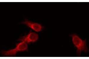 ABIN6275718 staining HeLa by IF/ICC. (RNF130 Antikörper  (Internal Region))