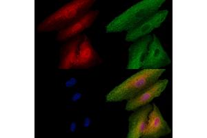 ABIN6256863 and ABIN6273491 staining  cells by IF/ICC. (MAPK13 Antikörper  (C-Term))