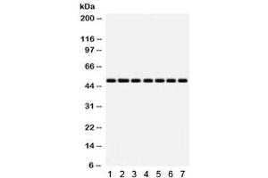 Western blot testing of 1) rat heart, 2) rat liver, 3) mouse NIH3T3, 4) human SW620, 5) HeLa, 6) MCF7 and 7) 22RV1 lysate with IDH2 antibody. (IDH2 Antikörper)