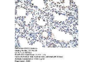 Rabbit Anti-CSDC2 Antibody  Paraffin Embedded Tissue: Human Lung Cellular Data: Alveolar cells Antibody Concentration: 4. (CSDC2 Antikörper  (N-Term))