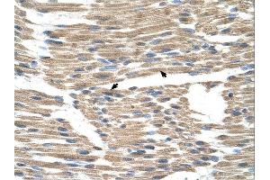GPR177 antibody was used for immunohistochemistry at a concentration of 4-8 ug/ml. (GPR177/WLS Antikörper  (N-Term))