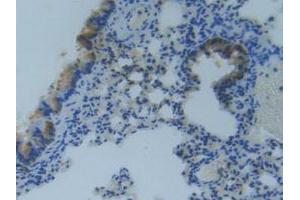 IHC-P analysis of Mouse Lung Tissue, with DAB staining. (MMP14 Antikörper  (AA 121-487))
