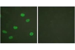 Immunofluorescence analysis of HeLa cells, using Lamin A/C (Phospho-Ser392) Antibody. (Lamin A/C Antikörper  (pSer392))
