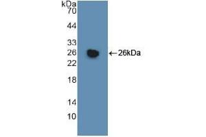 Western blot analysis of recombinant Human GSTm1.