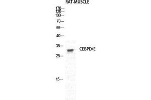 Western Blot (WB) analysis of Rat Muscle cells using C/EBP delta/epsilon Polyclonal Antibody. (C/EBP delta/epsilon (C-Term) Antikörper)