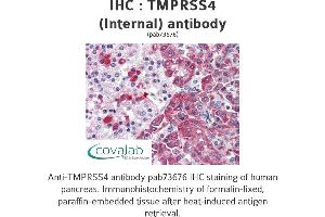 Image no. 1 for anti-Transmembrane Protease, serine 4 (TMPRSS4) (Internal Region) antibody (ABIN1740175)