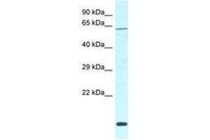 Image no. 1 for anti-DDB1 and CUL4 Associated Factor 11 (DCAF11) (AA 335-384) antibody (ABIN6747763) (DCAF11 Antikörper  (AA 335-384))