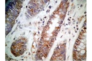 Human colon tissue was stained by Rabbit Anti-GLP-1 (12-24) (Human) Antibody (GLP-1 Antikörper  (AA 12-24))