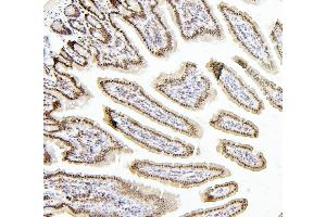 IHC analysis of PTBP1 using anti-PTBP1 antibody (ABIN7599451). (PTBP1 Antikörper  (AA 1-504))