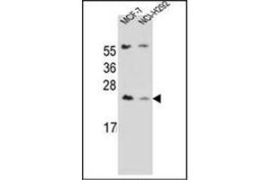 Western blot analysis of LIN7C Antibdy (C-term) in MCF-7, NCI-H292 cell line lysates (35ug/lane). (LIN7C Antikörper  (C-Term))