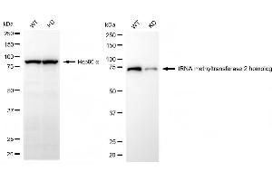 Western blotting analysis using tRNA methyltransferase 2 homolog antibody (ABIN7800983). (Rekombinanter TRNA Methyltransferase 2 Homolog Antikörper)