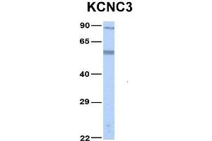 Host:  Rabbit  Target Name:  KCNC3  Sample Type:  Human Fetal Lung  Antibody Dilution:  1. (KCNC3 Antikörper  (Middle Region))