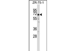 POU2F2 Antibody (N-term) (ABIN657763 and ABIN2846741) western blot analysis in ZR-75-1 cell line lysates (35 μg/lane). (Oct-2 Antikörper  (N-Term))