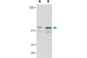 Western blot analysis of PAK2 in Jurkat lysate with PAK2 polyclonal antibody  at (A) 0. (PAK2 Antikörper  (C-Term))