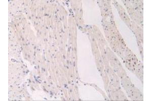 IHC-P analysis of Mouse Heart Tissue, with DAB staining. (FLT1 Antikörper  (AA 27-329))