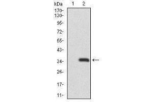 Image no. 2 for anti-Recombination Activating Gene 1 (RAG1) antibody (ABIN1491682) (RAG1 Antikörper)