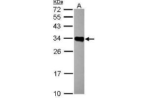 WB Image Sample (30 ug of whole cell lysate) A: Raji 12% SDS PAGE antibody diluted at 1:1000 (HLA-DRB1 Antikörper)