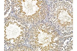 ABIN6257415 and ABIN6275226 at 1/100 staining rat testis tissue by IHC-P. (PGRMC2 Antikörper  (C-Term))