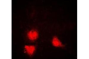 Immunofluorescent analysis of SIRT1 staining in Jurkat cells. (SIRT1 Antikörper)