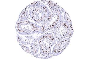Testis with gradual decrease of 53BP1 staining with maturation of germ cells. (Rekombinanter TP53BP1 Antikörper  (C-Term))