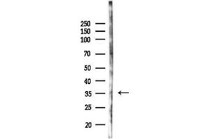 Western blot analysis of lysates from K562 cells(UV 30 min treatment), using ZNF364 Antibody at 1/1000 dilution.