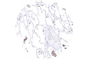 Alveolar macrophages show strong TIM 3 immunostaining (Rekombinanter TIM3 Antikörper)