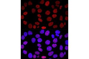Confocal immunofluorescence analysis of HeLa cells using Histone H2AX Polyclonal Antibody (ABIN6134695, ABIN6141564, ABIN6141567 and ABIN6219268) at dilution of 1:200. (Histone H2A Antikörper)