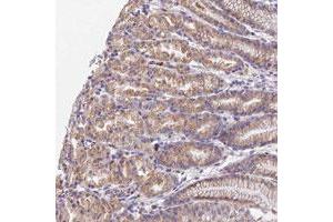 Immunohistochemical staining of human stomach with WDR5B polyclonal antibody , upper shows moderate cytoplasmic positivity in glandular cells at 1:10-1:20 dilution.