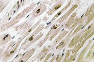 Immunohistochemistry (IHC) analyzes of PAKγ antibody in paraffin-embedded human heart tissue. (PAK2 Antikörper)