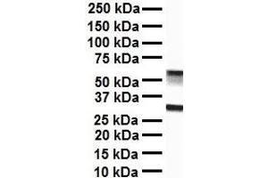WB Suggested Anti-ZFX antibody Titration: 1 ug/mL Sample Type: Human liver (ZFX Antikörper  (C-Term))