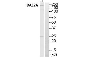 Western blot analysis of extracts from Jurkat cells, using BAZ2A antibody. (BAZ2A Antikörper  (Internal Region))
