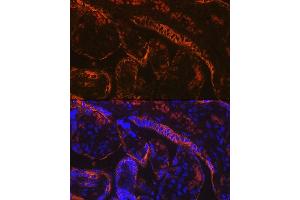 Immunofluorescence analysis of human placenta using Aromatase (CYP19) Rabbit mAb (2238) at dilution of 1:100 (40x lens). (Aromatase Antikörper)