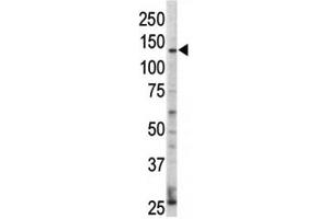 Western blot analysis of ErbB4 / HER4 antibody and HL-60 cell lysate. (ERBB4 Antikörper  (AA 25-55))