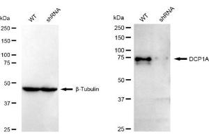 Western blotting analysis using DCP1A antibody (ABIN7798280).