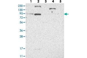 Western blot analysis of Lane 1: RT-4, Lane 2: U-251 MG, Lane 3: Human Plasma, Lane 4: Liver, Lane 5: Tonsil with LCA5 polyclonal antibody .