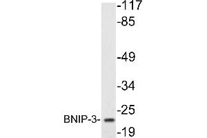 Western blot (WB) analysis of BNIP-3 antibody in extracts from K562cells. (BNIP3 Antikörper)