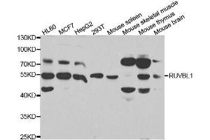 Western blot analysis of extracts of various cell lines, using RUVBL1 antibody. (RUVBL1 Antikörper  (AA 1-240))