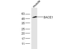 Mouse muscle lysates probed with Rabbit Anti-BACE1 Polyclonal Antibody, Unconjugated  at 1:5000 for 90 min at 37˚C. (BACE1 Antikörper  (AA 401-501))