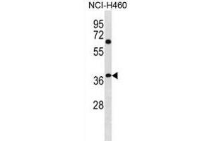 NHLRC3 Antibody (C-term) (ABIN1881580 and ABIN2838947) western blot analysis in NCI- cell line lysates (35 μg/lane). (NHLRC3 Antikörper  (C-Term))