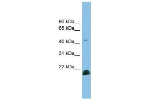 WB Suggested Anti-TGFB2 Antibody Titration: 0. (TGFB2 Antikörper  (Middle Region))