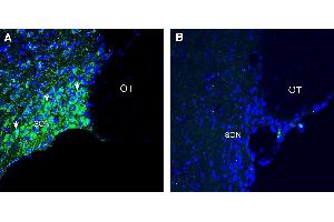 anti-Chemokine-Like Receptor 1 (CMKLR1) (AA 201-215), (Extracellular) antibody